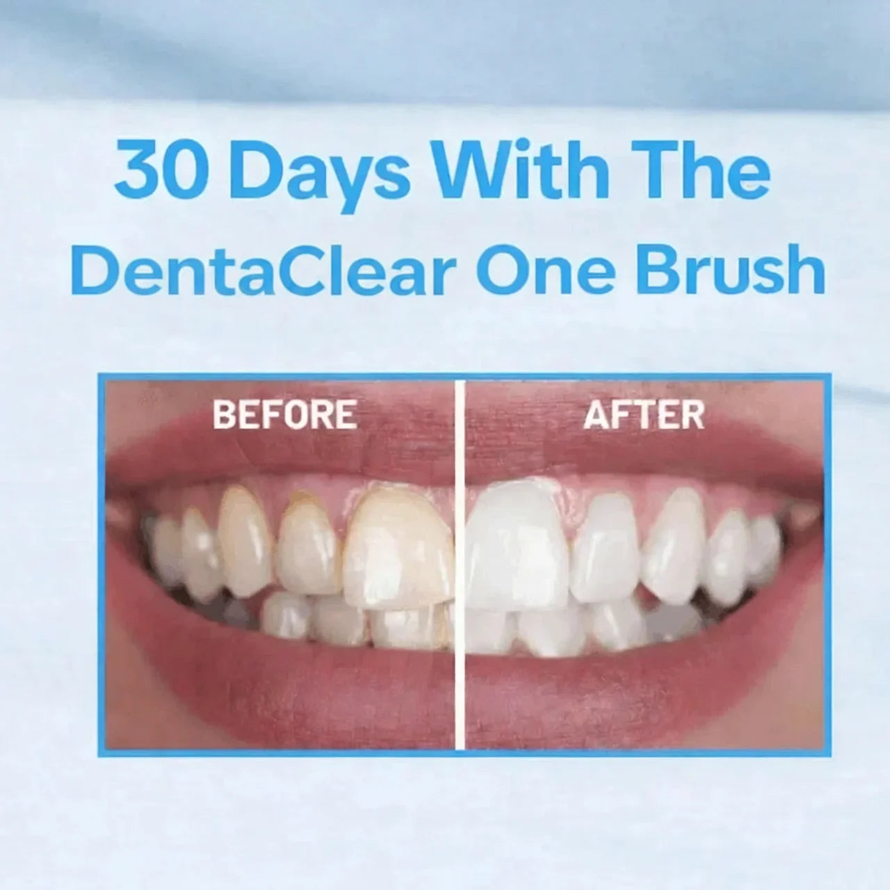 DentaClear One