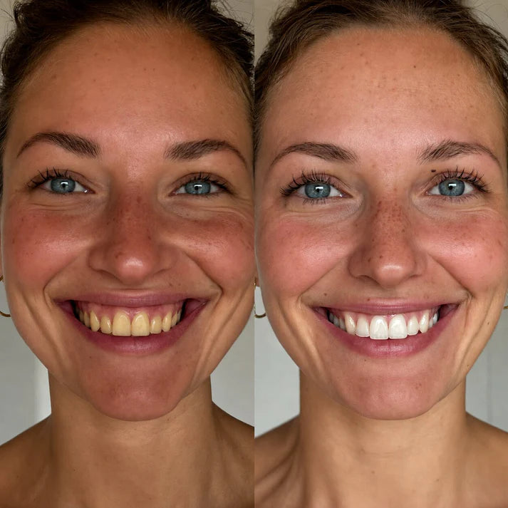 DentaClear One