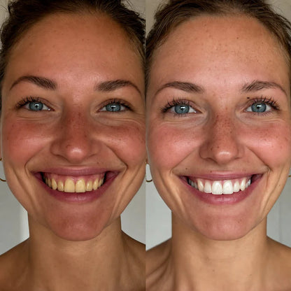 DentaClear One